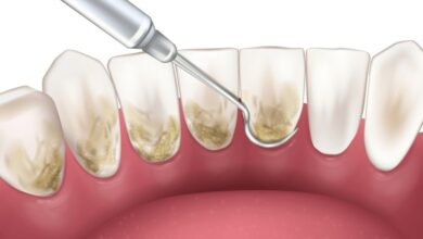 teeth cleaning frequency